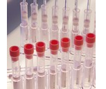 SEDI RATE Erythrocyte Sedimentation Rate - box 200 uni